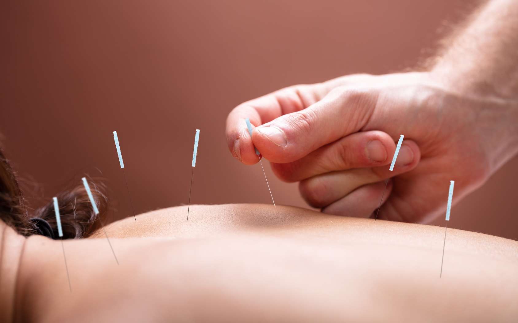 acupuncture-grossesse