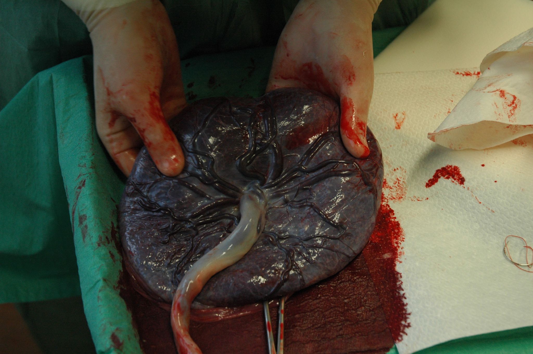 placenta-image